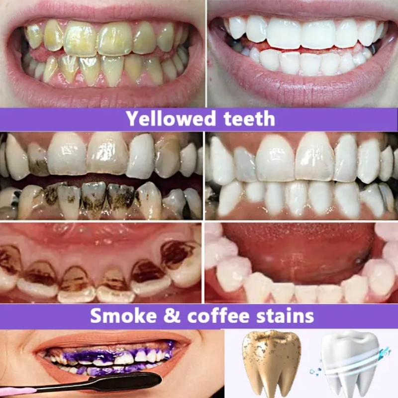 Pasta de Dente Clareadora Mais - Teeth Whitening Effective avaliação e preço