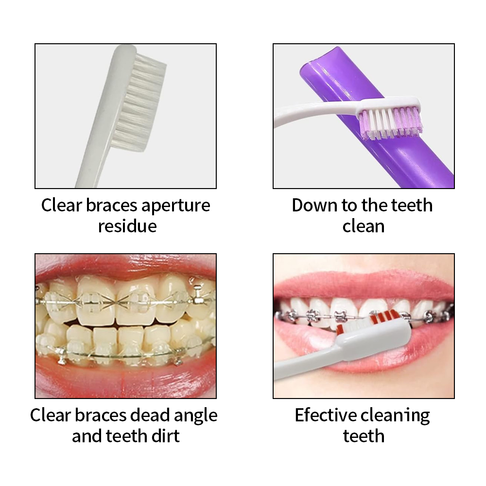 8 pçs/set ortodôntico kit esco - Teeth Whitening For Braces avaliação e preço