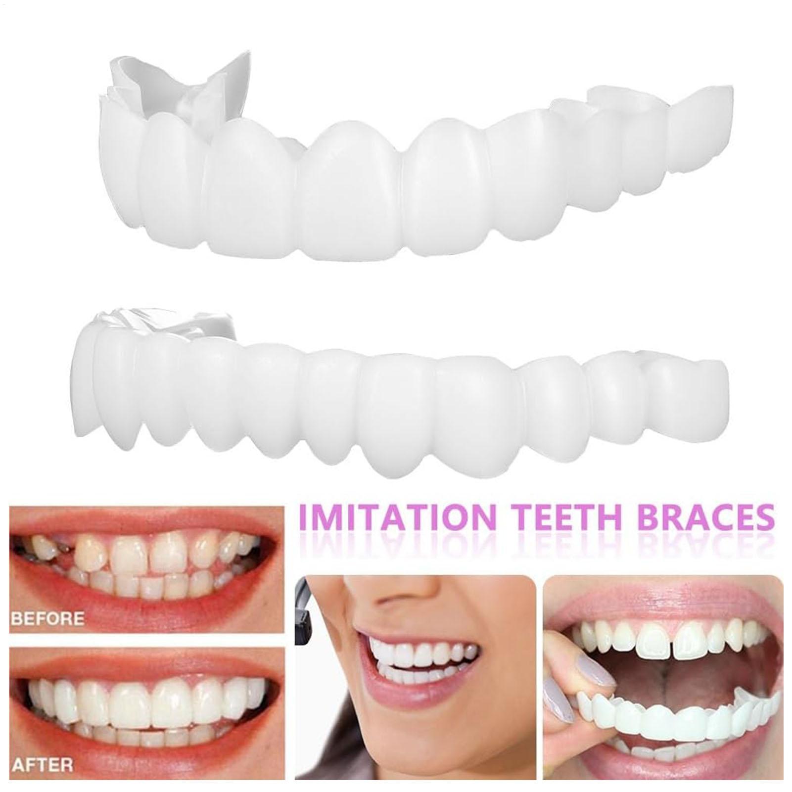 Capa Dentária Superior e Infer - Teeth Whitening For Braces avaliação e preço