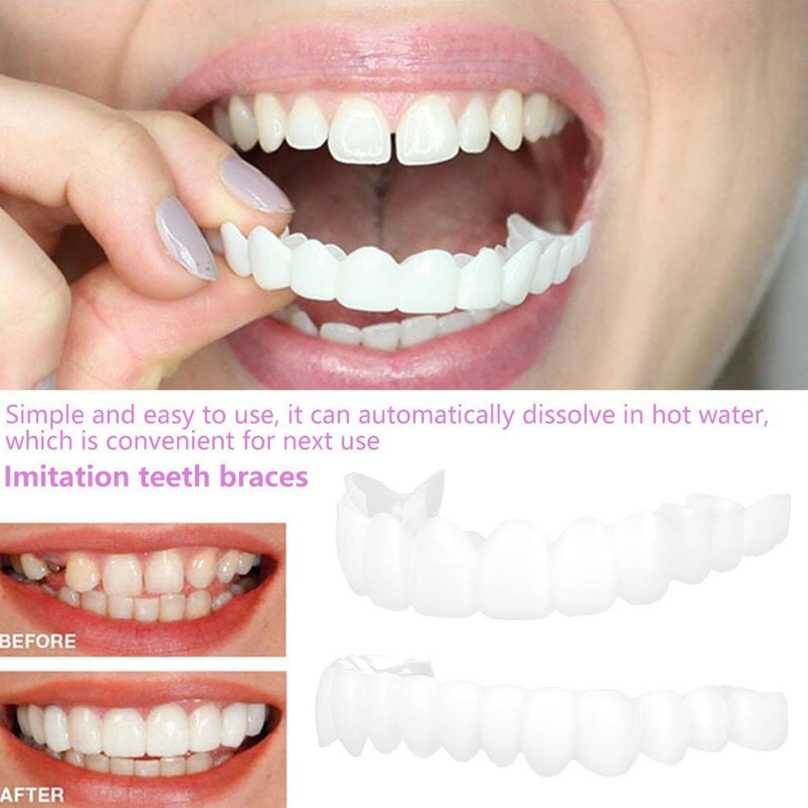Capa Dentária Superior e Infer - Teeth Whitening For Braces avaliação e preço