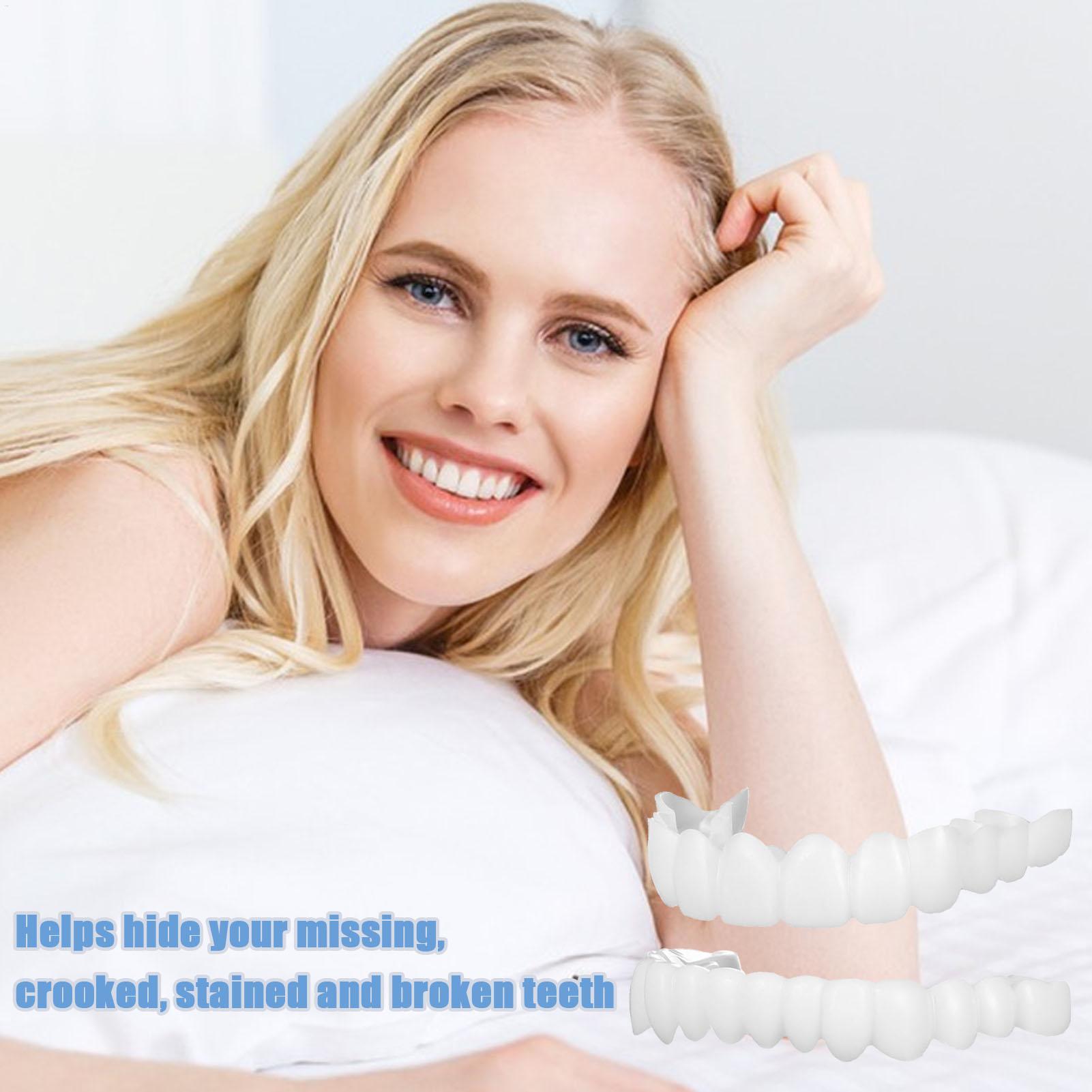 Capa Dentária Superior e Infer - Teeth Whitening For Braces avaliação e preço