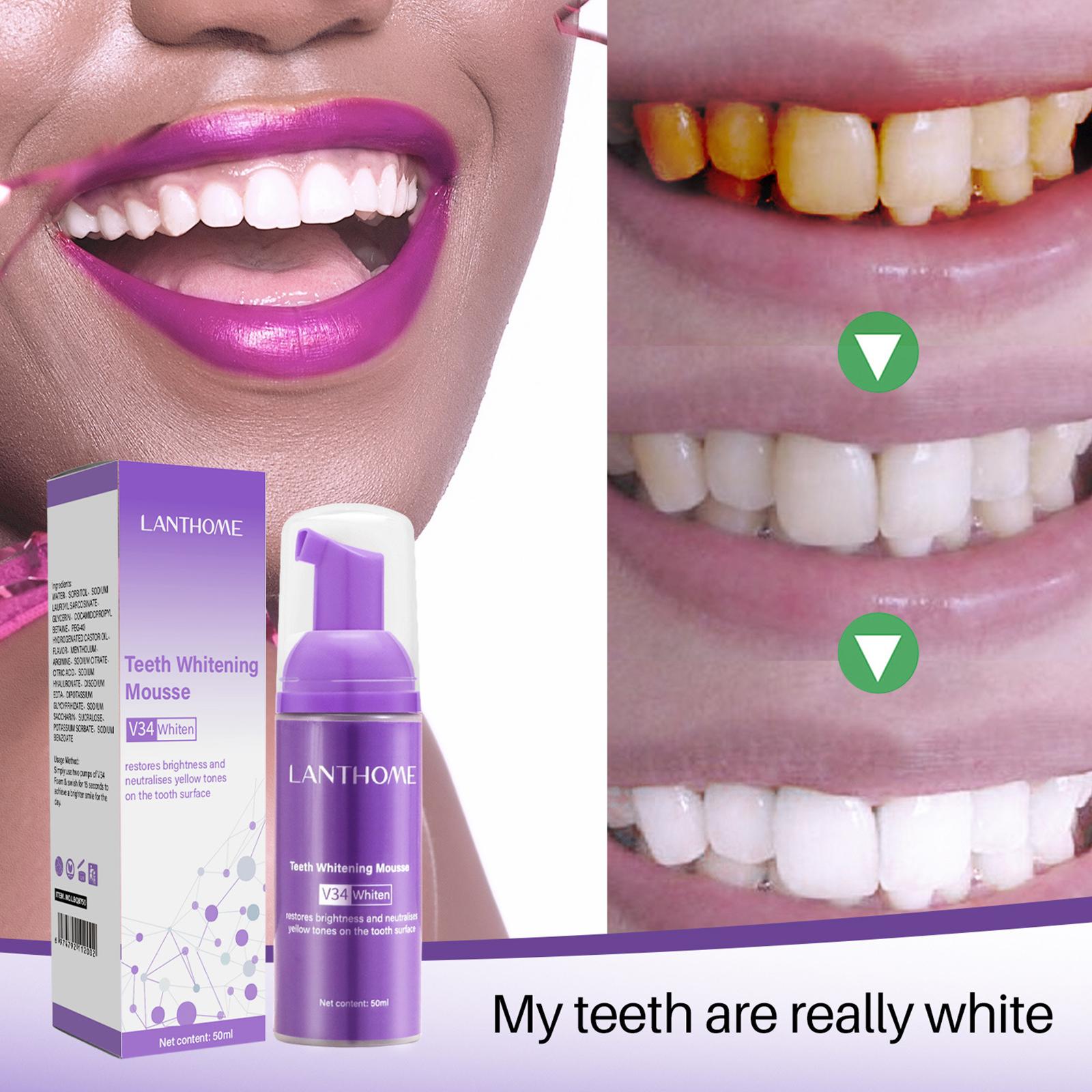V34 mousse limpeza dos dentes  - Teeth Whitening Effective avaliação e preço