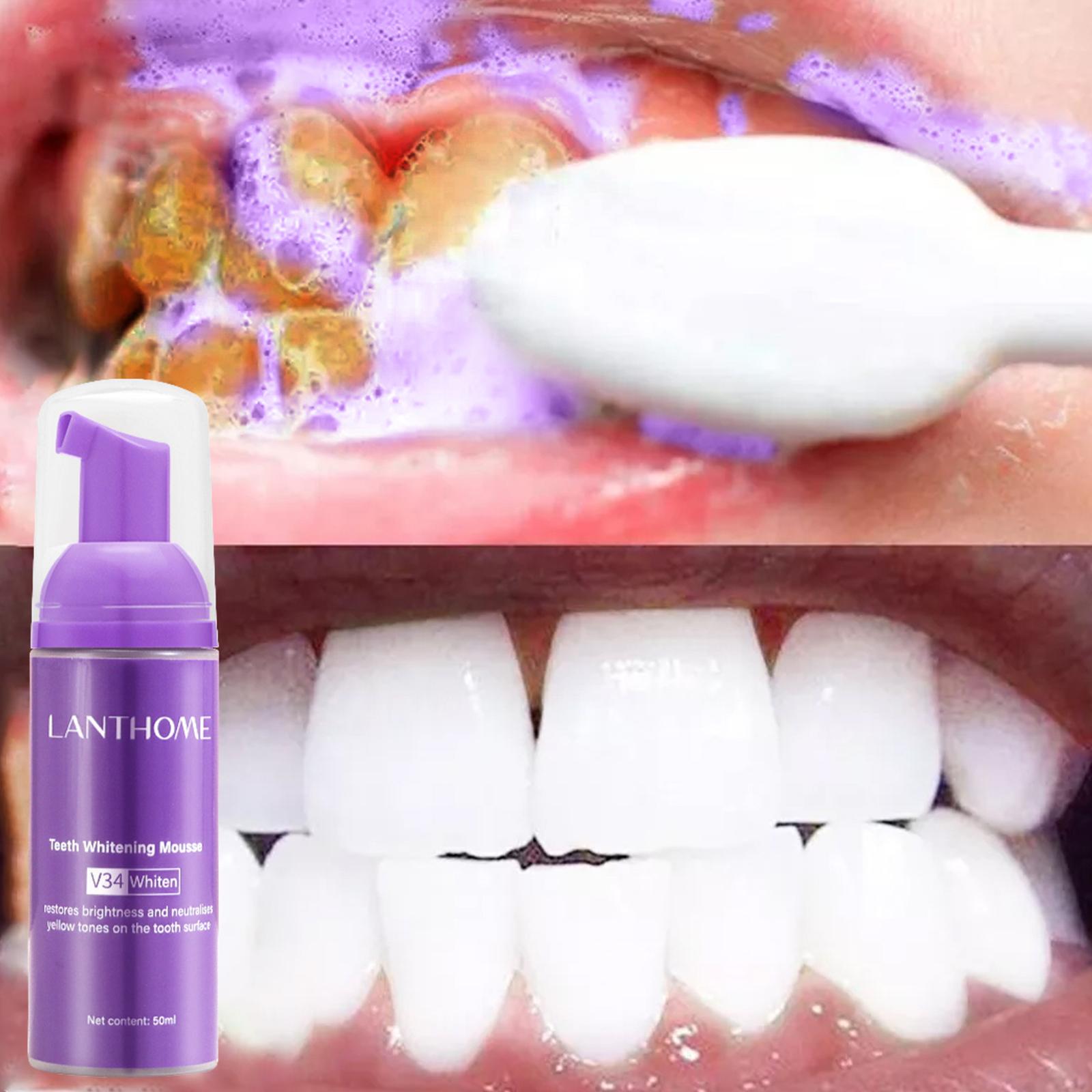 V34 mousse limpeza dos dentes  - Teeth Whitening Effective avaliação e preço