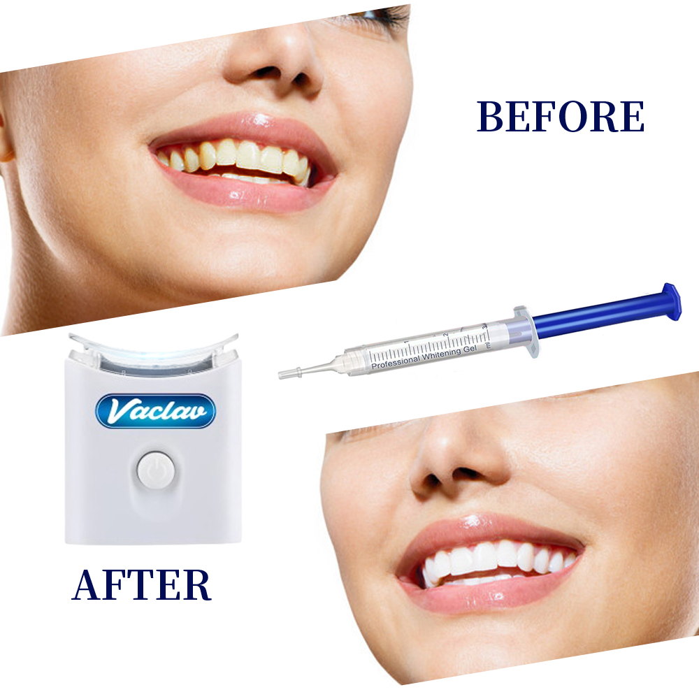 Seringa de gel para clareament - Teeth Whitening Kit At Home avaliação e preço
