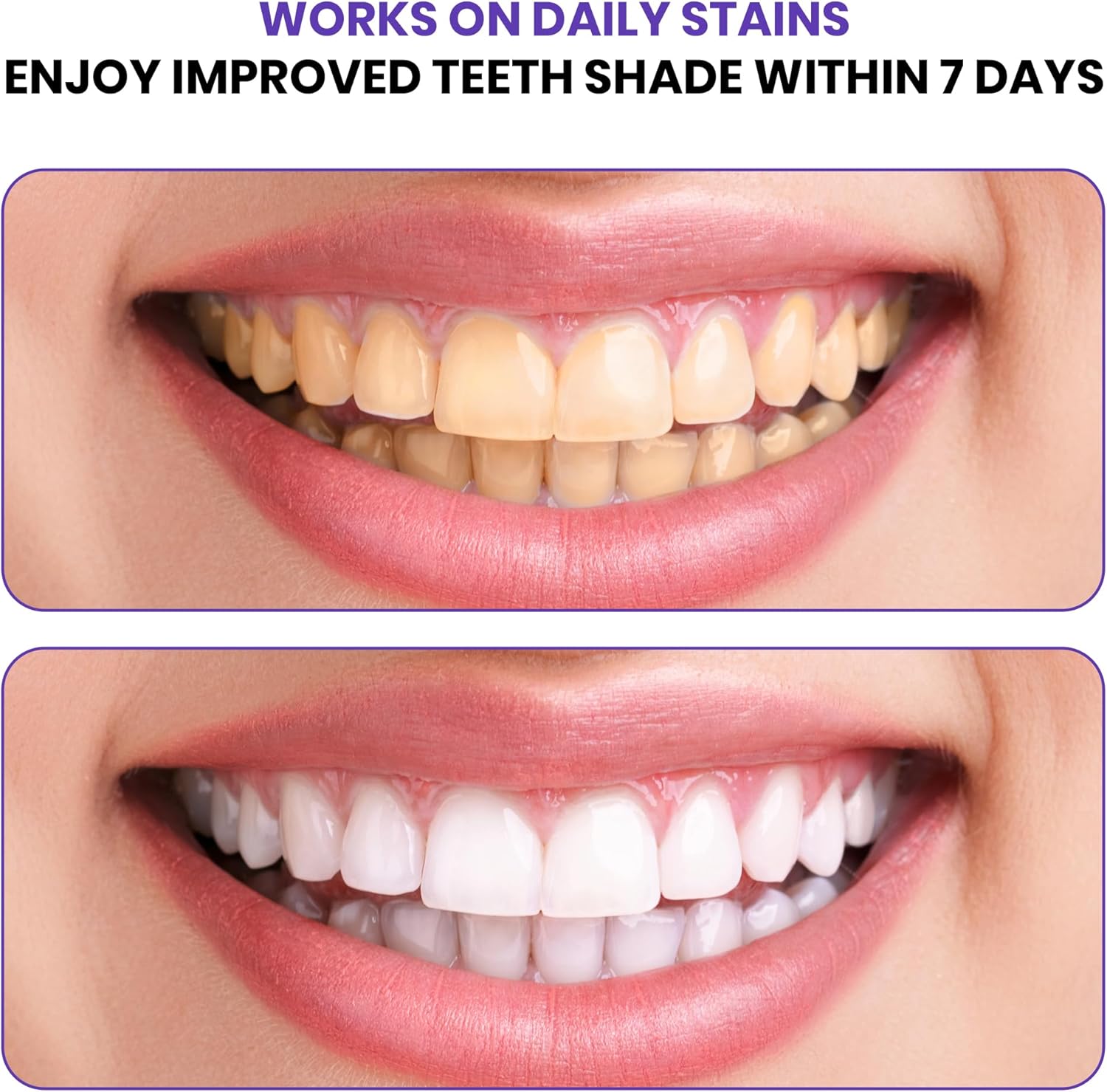 Sistema Avançado de Correção d - Teeth Whitening In Office avaliação e preço