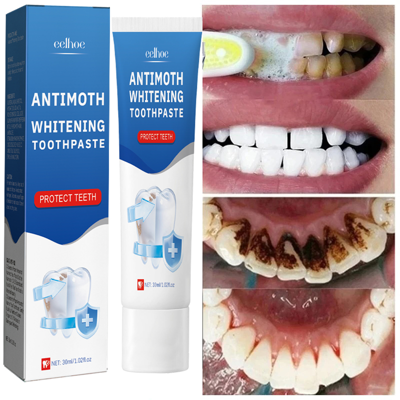Remoção rápida de manchas de f - Teeth Whitening Fast avaliação e preço