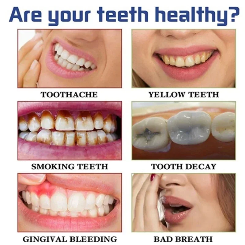 Remoção rápida de manchas de f - Teeth Whitening Fast avaliação e preço
