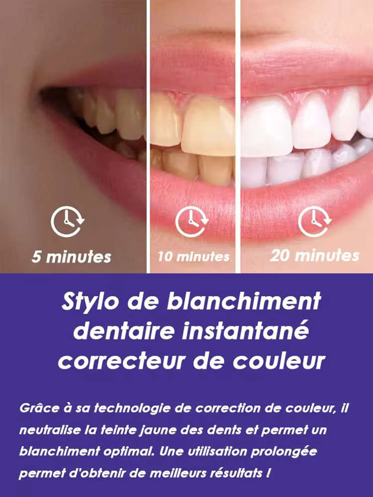 Conjunto de Canetas Clareadora - Teeth Whitening Effective avaliação e preço