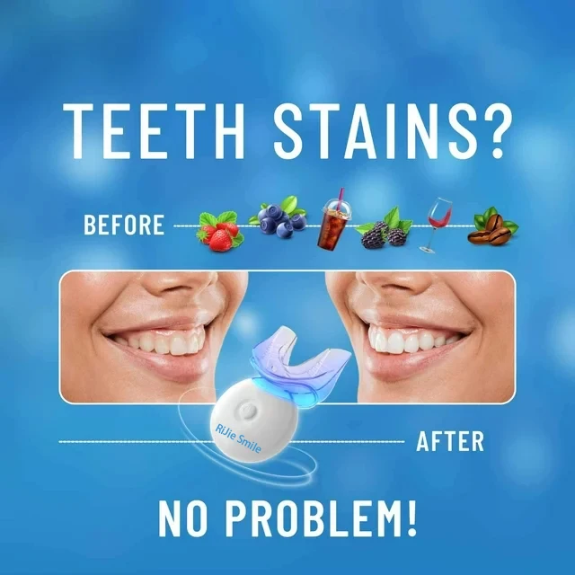 Kit de Limpeza de Alta Qualida - Teeth Whitening Kit At Home avaliação e preço
