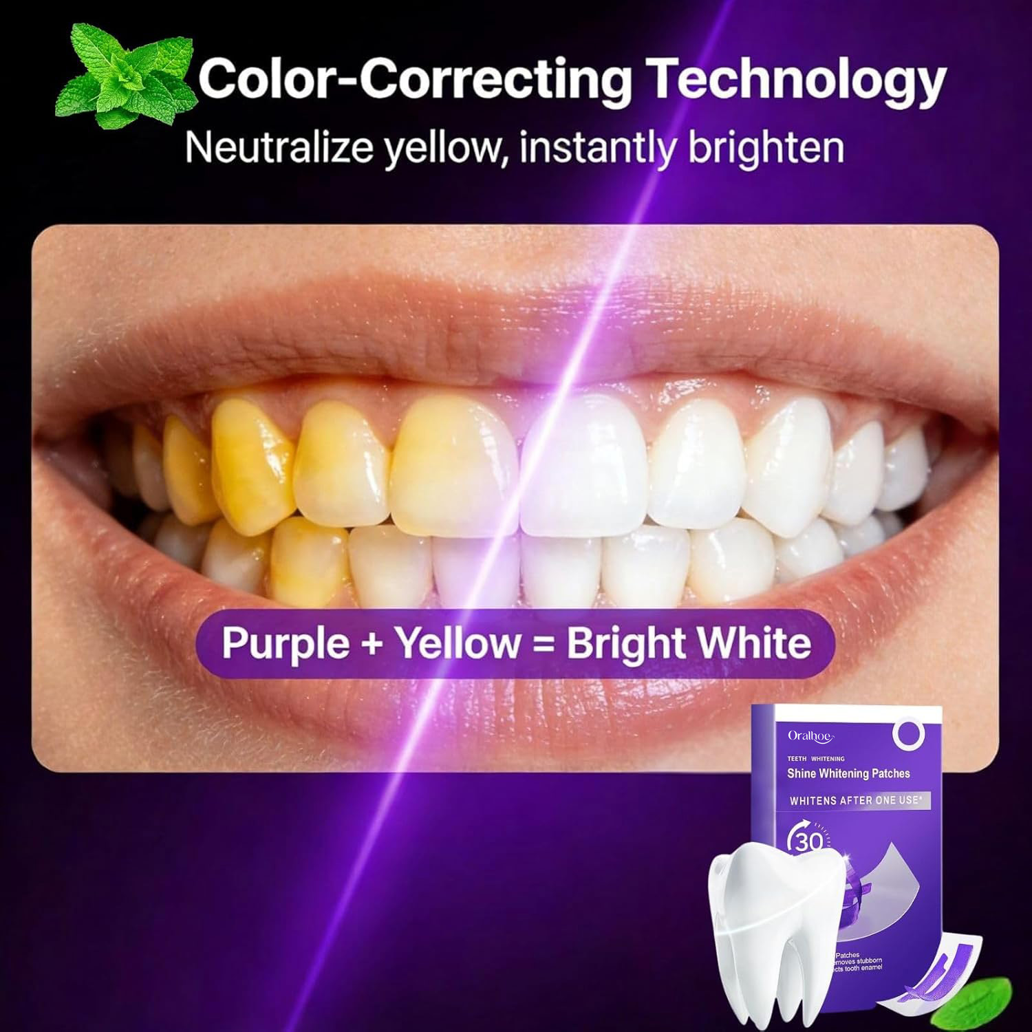 Kit Completo de Clareamento De - Teeth Whitening In Office avaliação e preço