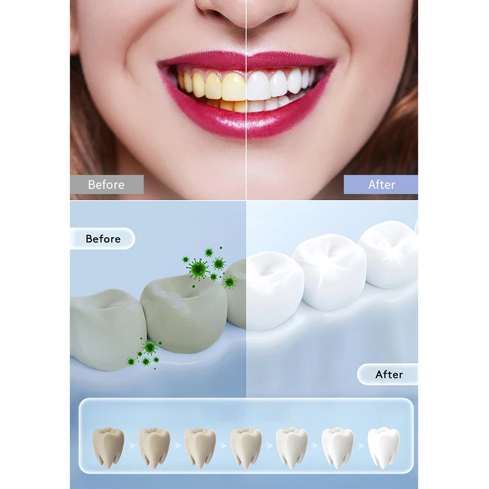 1pc casa inteligente led lâmpa - Teeth Whitening In Office avaliação e preço