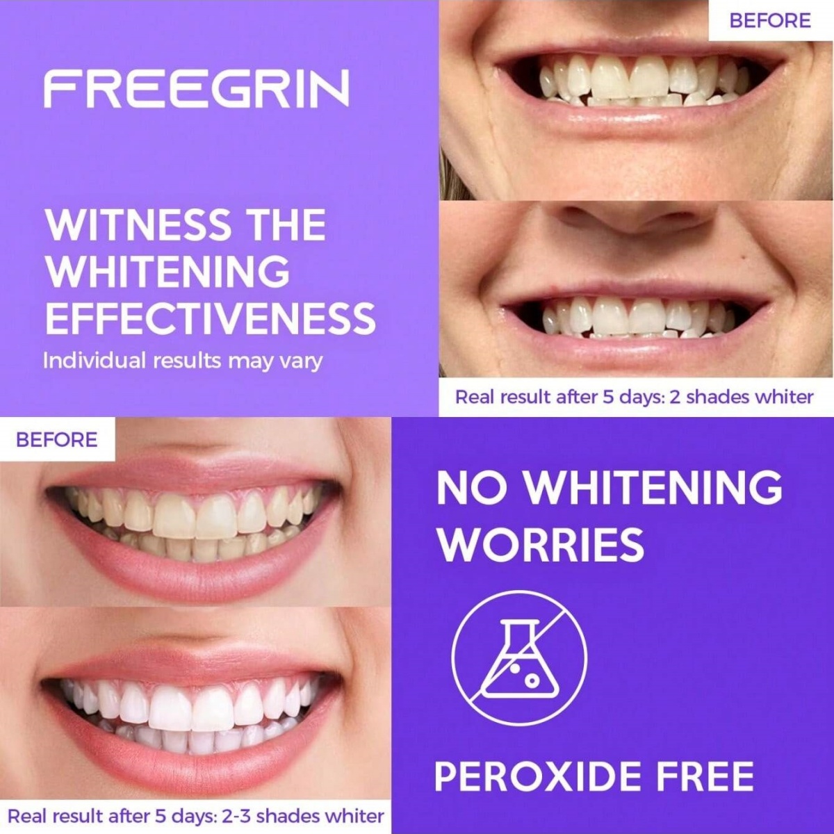 Adesivos de clareamento dental - Teeth Whitening In Office avaliação e preço