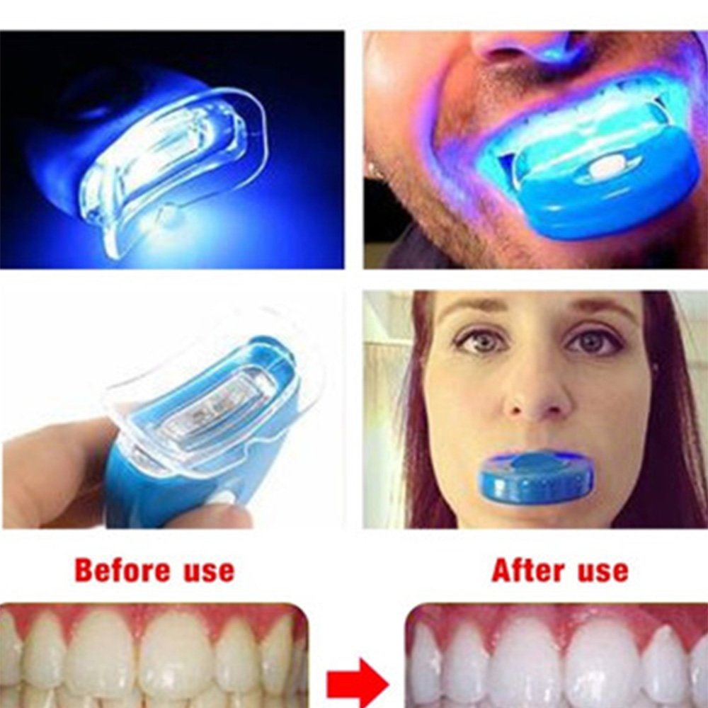 Acelerador de clareamento dent - Teeth Whitening In Office avaliação e preço
