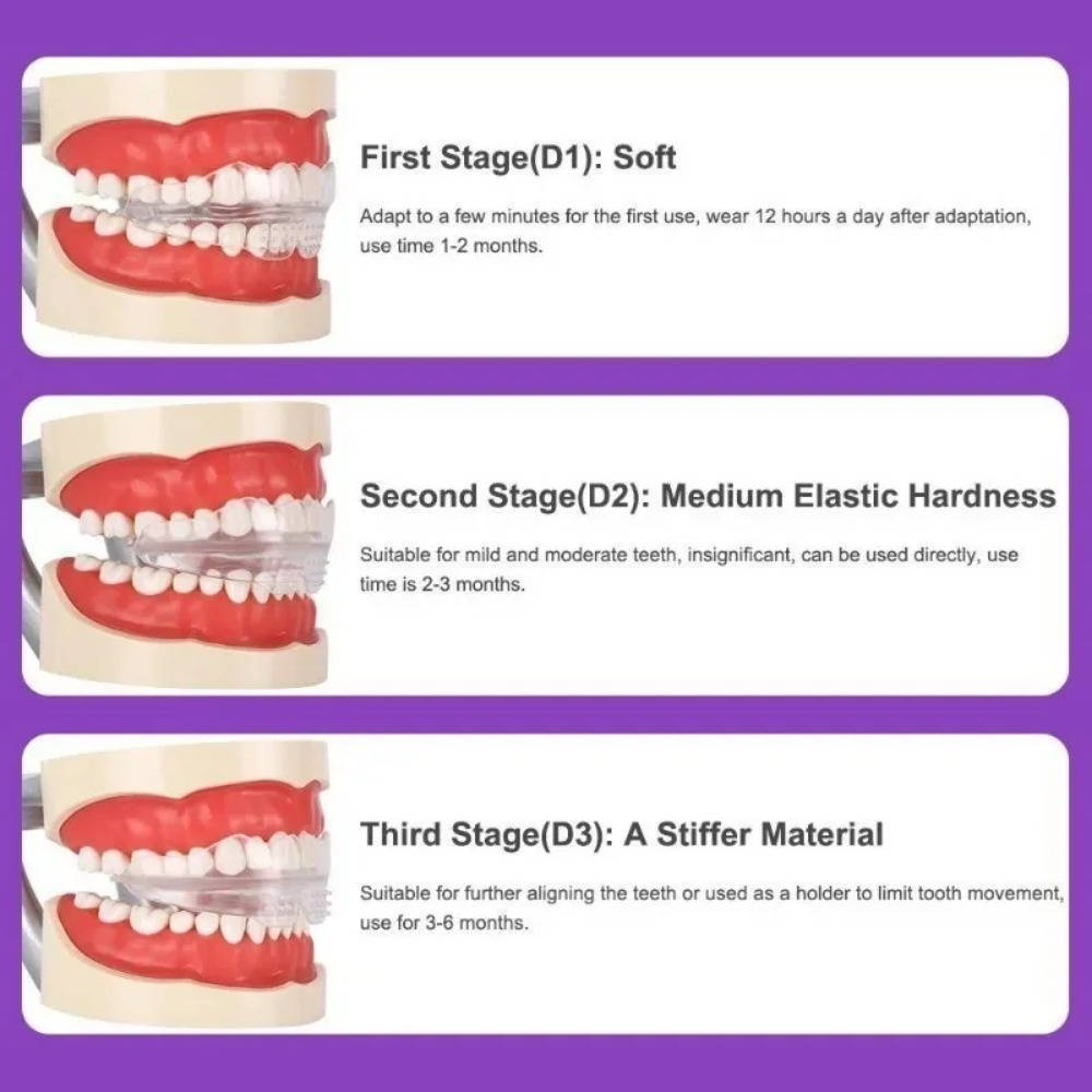 Aparelho Ortodôntico Alinhador - Teeth Whitening For Braces avaliação e preço