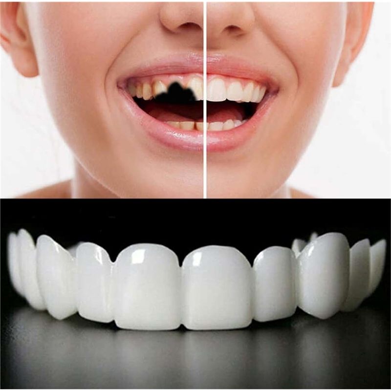 [NOVO! ABMK】 2 Pares, Restaure - Teeth Whitening For Braces avaliação e preço